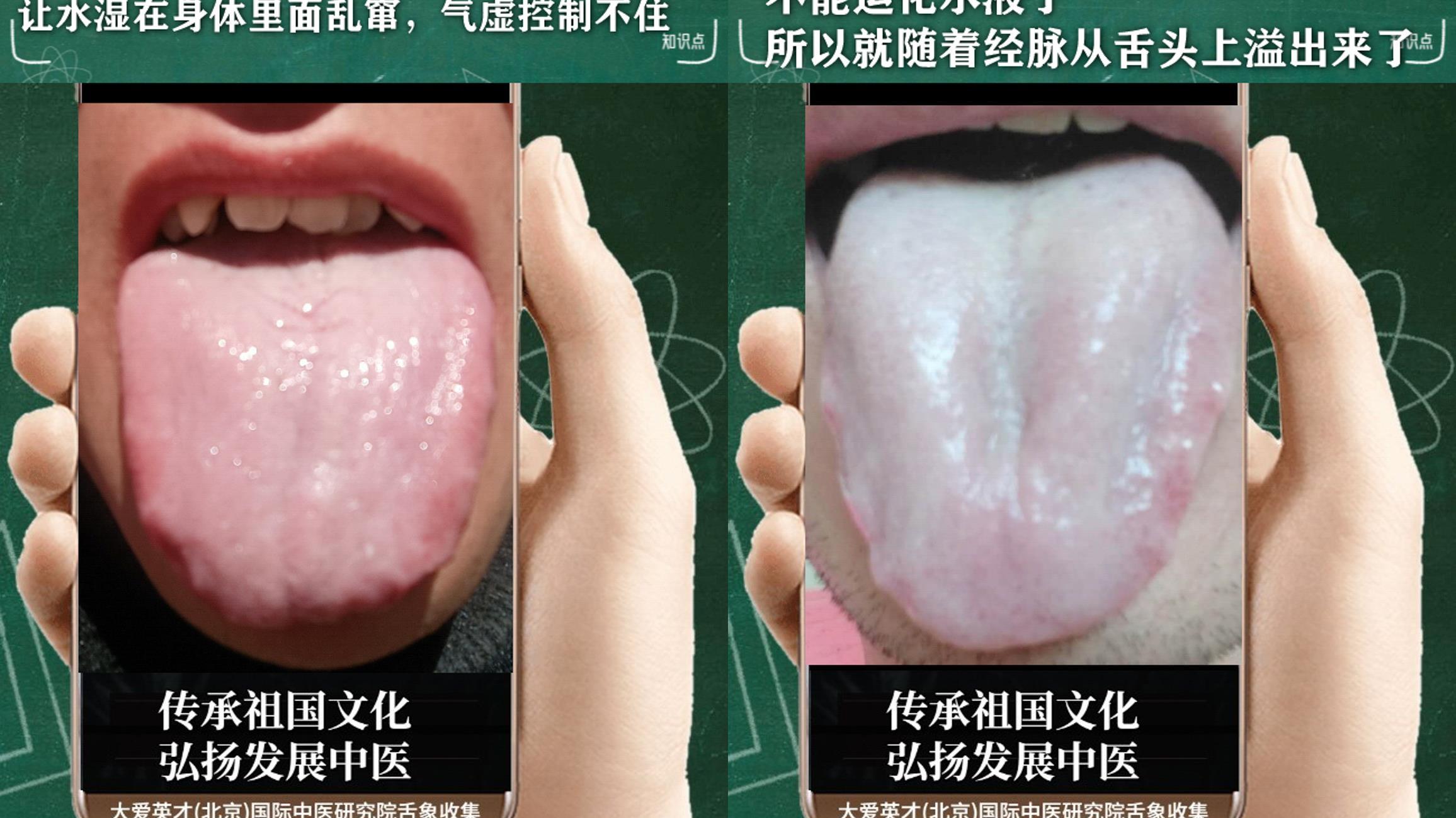 |中医实例：心烦易怒、易生气、容易困倦，肝郁克脾