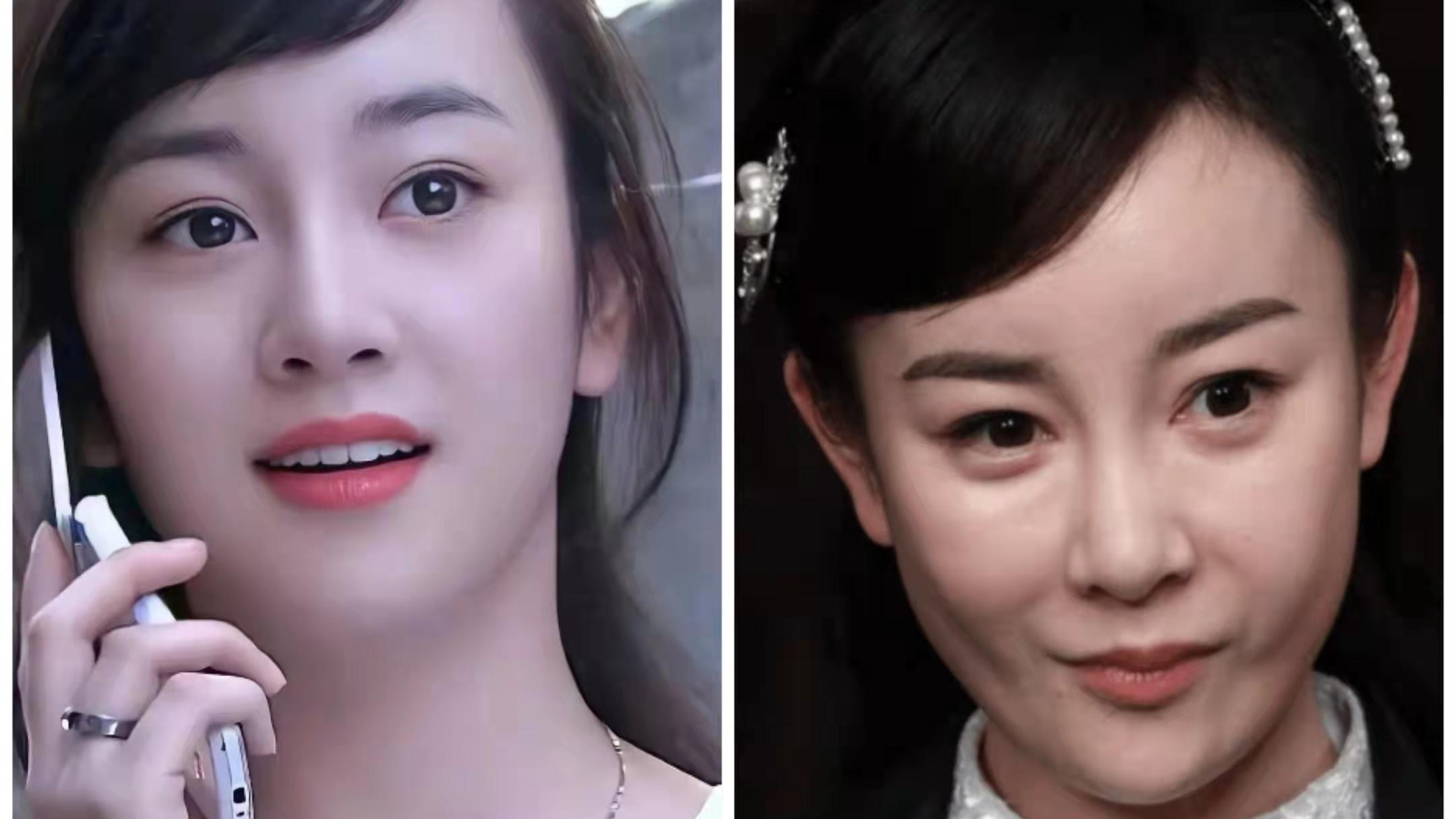 整容|整容最失败的女明星，从清纯灵动到一脸硅胶，网友直呼太可惜了