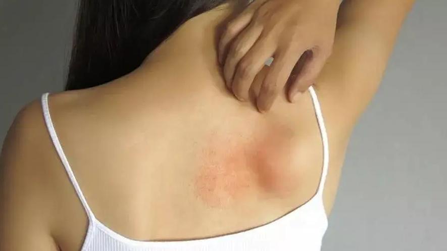 医学生|备孕时，这4种小病要提前治好，很多女性都懒得去医院了。