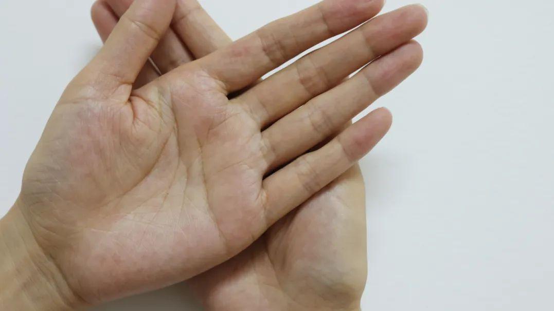 心血管疾病|血管健康的人，通常手指上会出现这3个特征，快来看看你有没有？