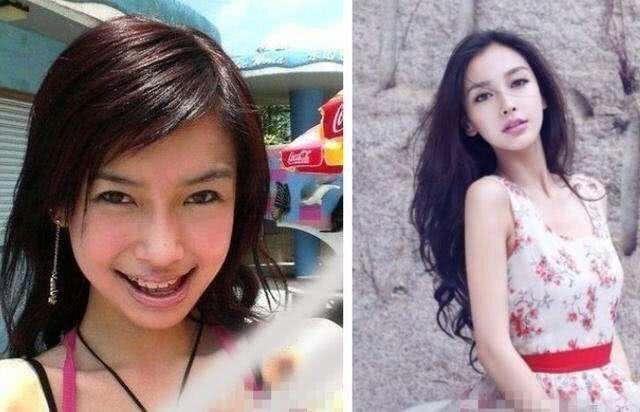 刘涛|刘涛自曝：花300万装副烤瓷牙，动不动就去修，很多角色都演不了