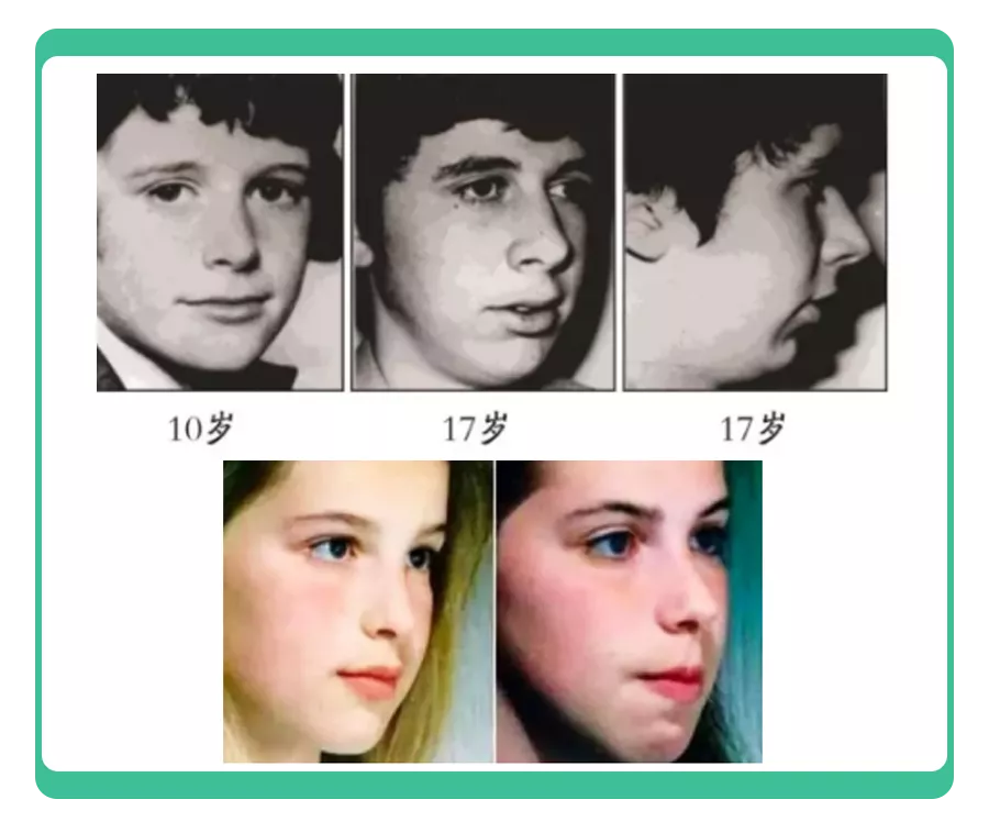 月销10万＋的口呼吸贴，别再给娃用了！背后的隐患医生都捏把汗