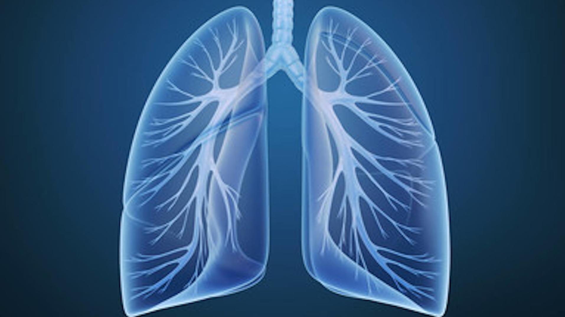 内科|什么是“白肺”？发生了白肺会有啥感觉和表现？如何早发现？
