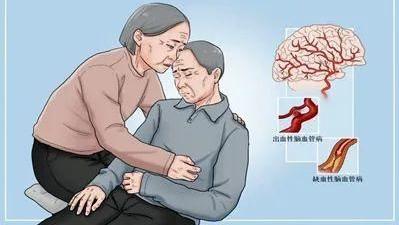 饮食|关于中风的9个常见误区！
