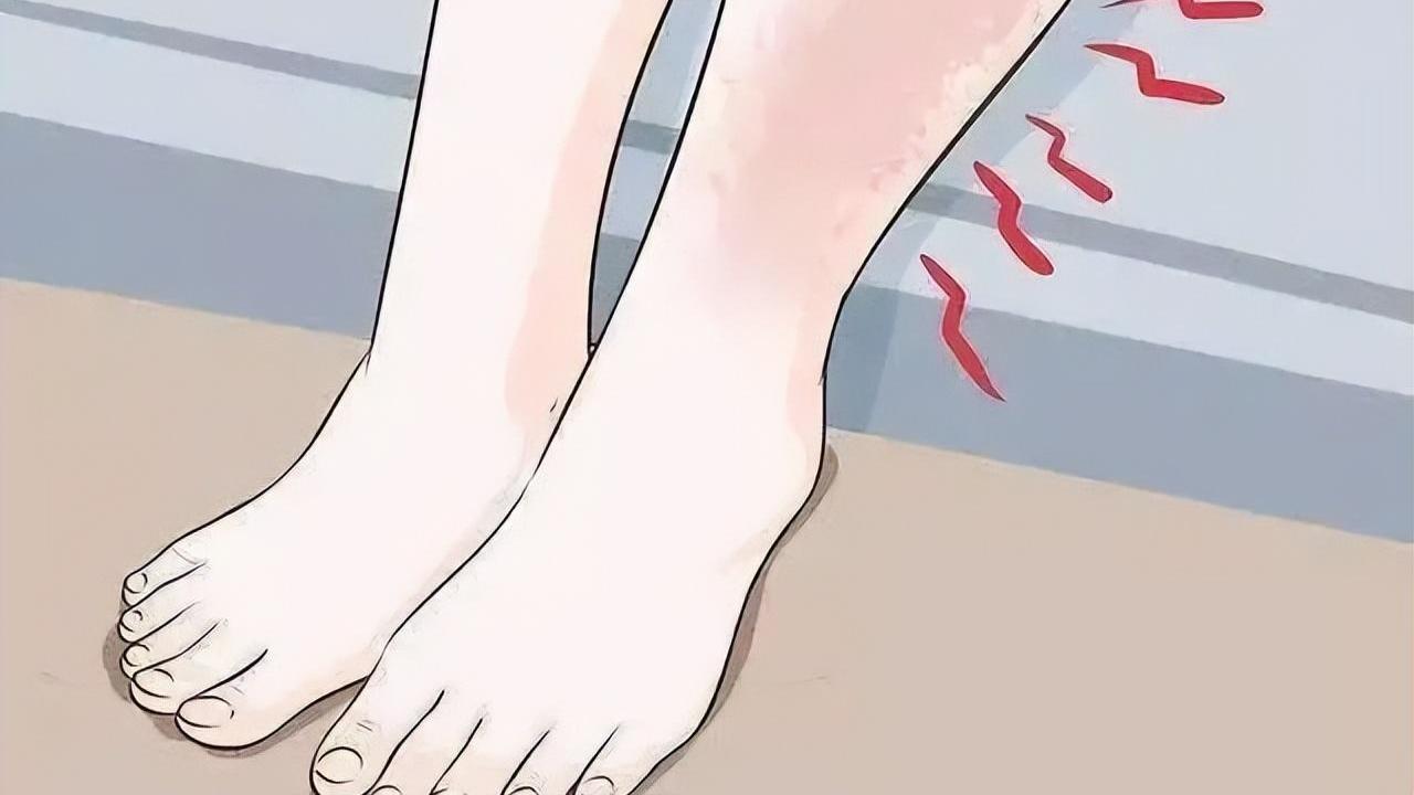 医生|癌症晚期全身水肿一直不见好转？可能是你没用对方法！