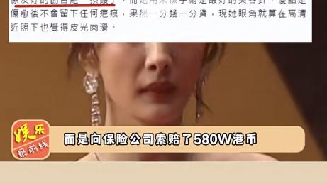 杨幂|杨幂受伤索赔500多万，工作室至今不敢发近照，拿旧图忽悠粉丝