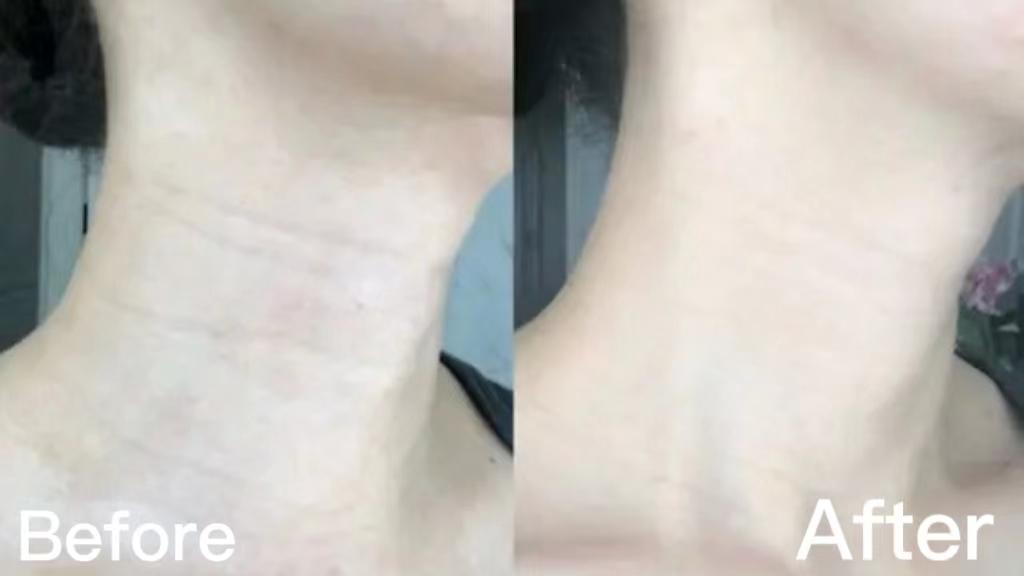 血糖|明明自己才20岁，却让人觉得你30＋？罪魁祸首竟然是“它”！