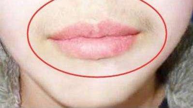 美容|有妇科病的女人，嘴巴可能有这四种现象，希望你一个都不占