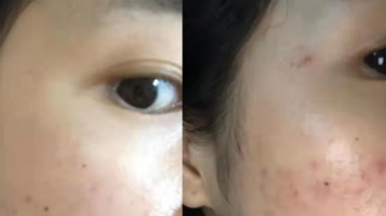 孕妇 孕期护肤毁容了？曝光“孕妇专用”惊天骗局！99%的宝妈都中过招