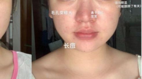 青椒|怀孕护肤变美有门道！孕期护肤3大误区，新手妈妈千万别掉“坑”