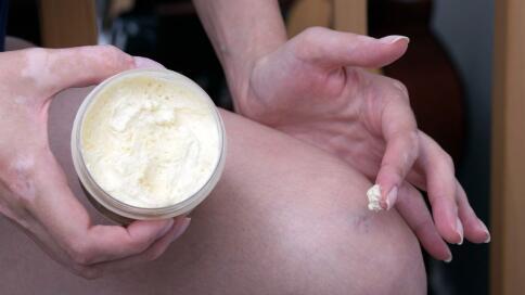 白癜风|为什么白癜风治好后皮损部位肤色较深？还会不会复发？