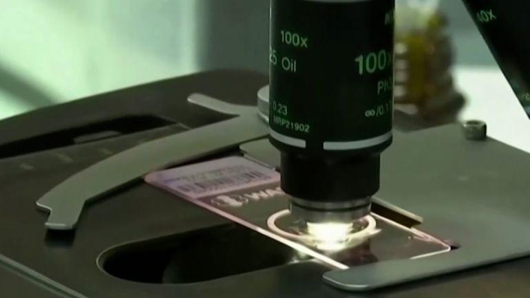 大脑|以色列记录首例猴痘病例 世卫组织预计会有更多病例 ！