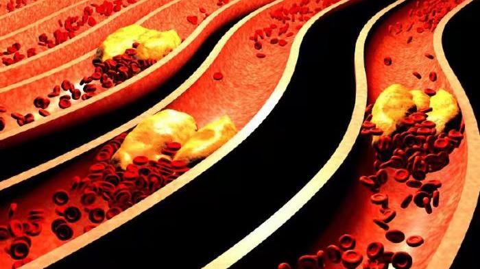 血糖|多所医院明令禁止：“1鸡蛋”正挖空你的胰岛，若不远离，血糖或黏如粥