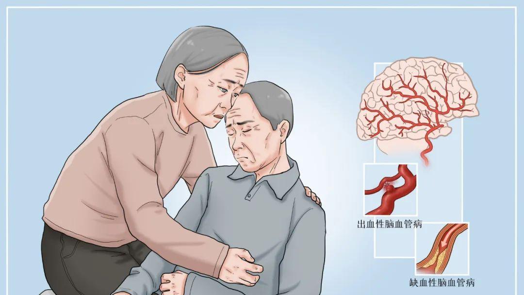 中风|“姜子牙”，走好！如果出现这4个症状，别大意，马上就医！