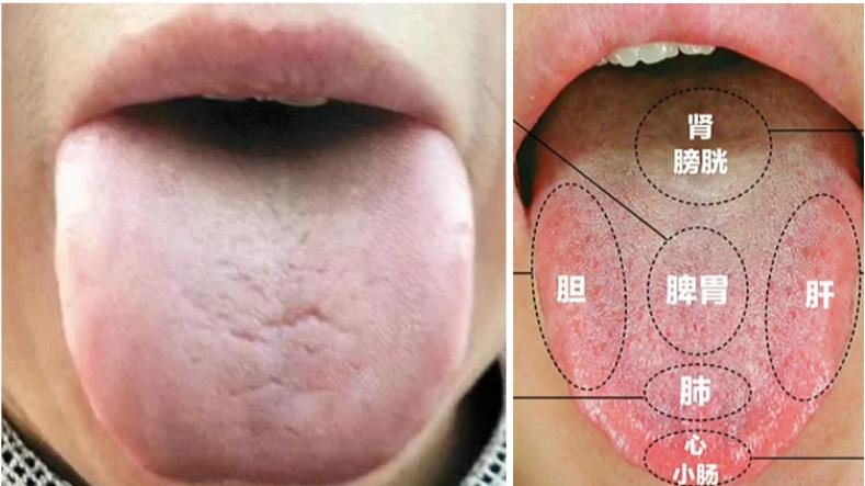 新型冠状肺炎|体质弱、抵抗力差易生病，中医教你一招，让你提高免疫力！