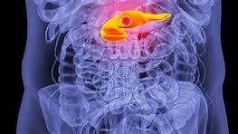 立秋|胰腺癌的病因有哪些，日常生活中需要注意些什么