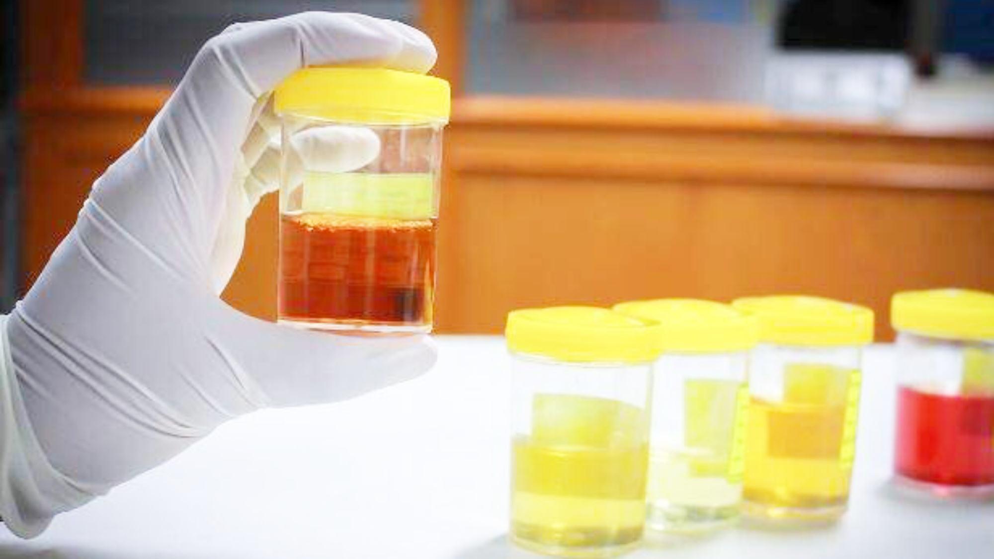 水果|中西药可以混用吗？保健食品跟药物一起吃安全吗？恐引发肾衰竭