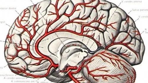 脑梗|身体出现4个“怪兆”，可能是脑血管正在“堵塞”，早察觉早受益