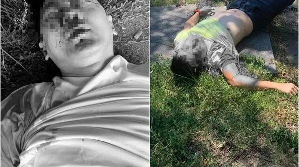 林志颖|?最新！林志颖伤势曝光