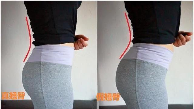 医生|如何分辨真假臀？29岁热巴塑形2年拥有蜜桃臀，三个动作超实用