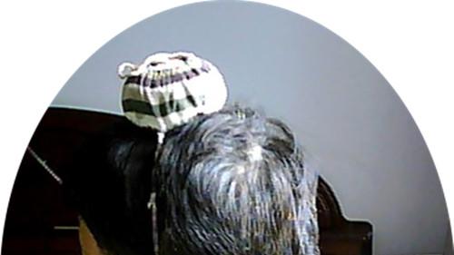 感冒|前几天我也感冒了我用艾灸治愈了