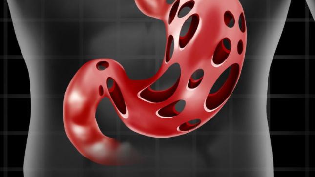 胃癌|消化科专家：3种病是胃癌的“引路人”，若一忍再忍，或会掏空肠胃