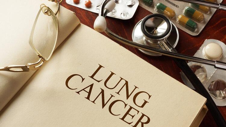 广东省|72岁肿瘤专家患癌，抗癌一年逝世，生前的后悔，令人警醒