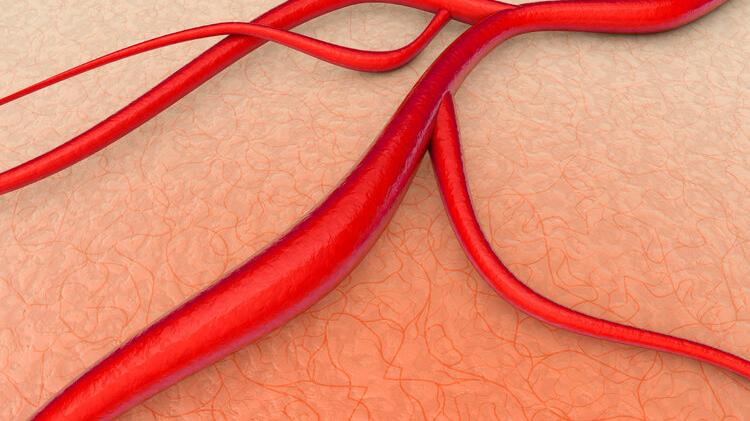 |低密度脂蛋白是“血管垃圾制造者”，这4个方法，可以帮你来降低