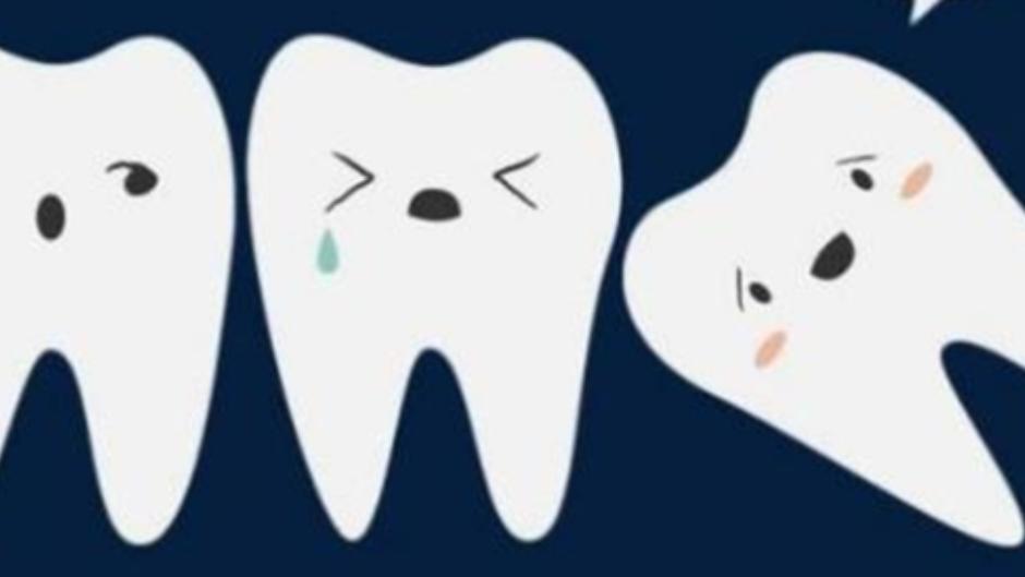 |智齿最好什么时候拔？