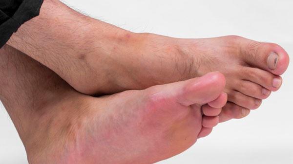 排毒|“百病始于脚”！若脚部长期出现4种表现，可能是肝脏有问题了！