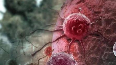 癌细胞|癌症扩散后，治疗还有用吗？出现3种症状，可能是癌细胞已经转移