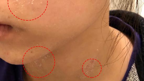 护肤品 小心点！你的护肤品存在烂脸黑名单上了吗？