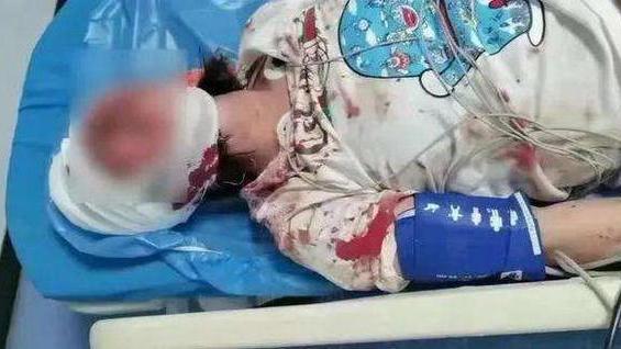 立法会|唐山被打女子身份疑曝光！仅19岁刚结束高考，李冰冰发声支援