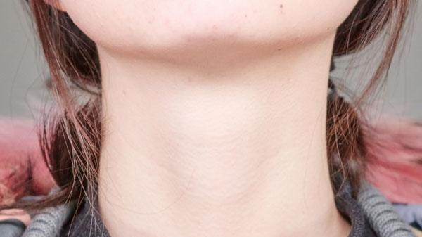 甲亢|得了甲亢的人，身体可能有6个异常变化，如果一个也没有，恭喜你