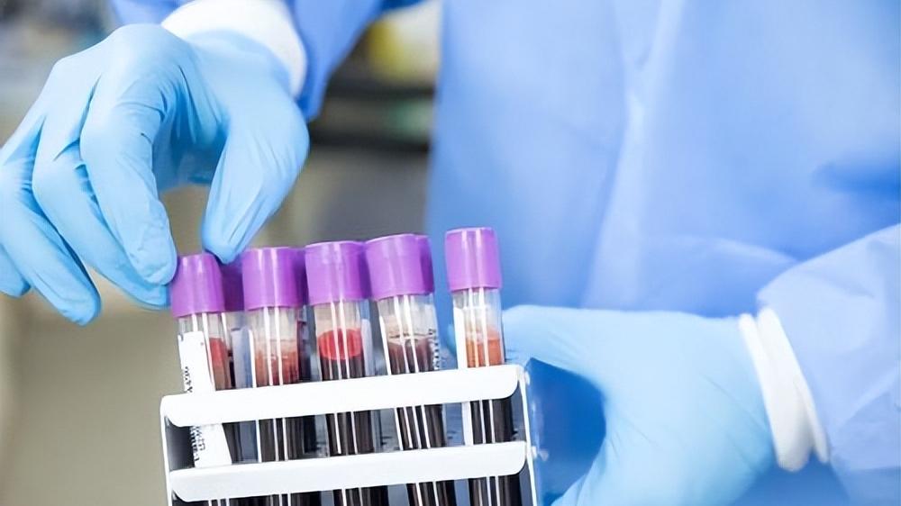 饮食|血脂高的人，怎么吃才能降血脂？除了饮食外，还需要注意什么？