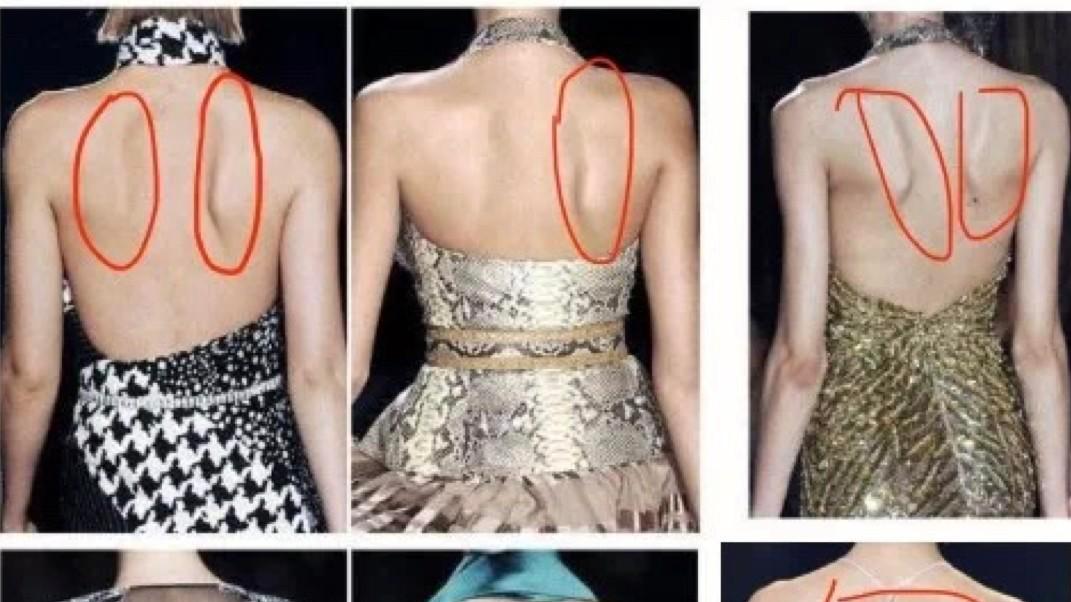 驼背|女性力量训练—练背背部肌肉没有感觉，六个小动作帮你轻松改善