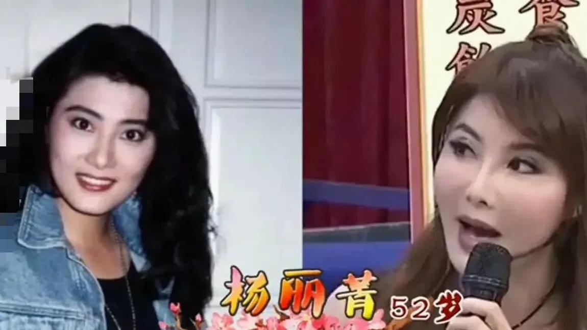 整容|中老年女星整容也疯狂，刘晓庆蔡明自讨苦吃，她却变“鞋拔脸”