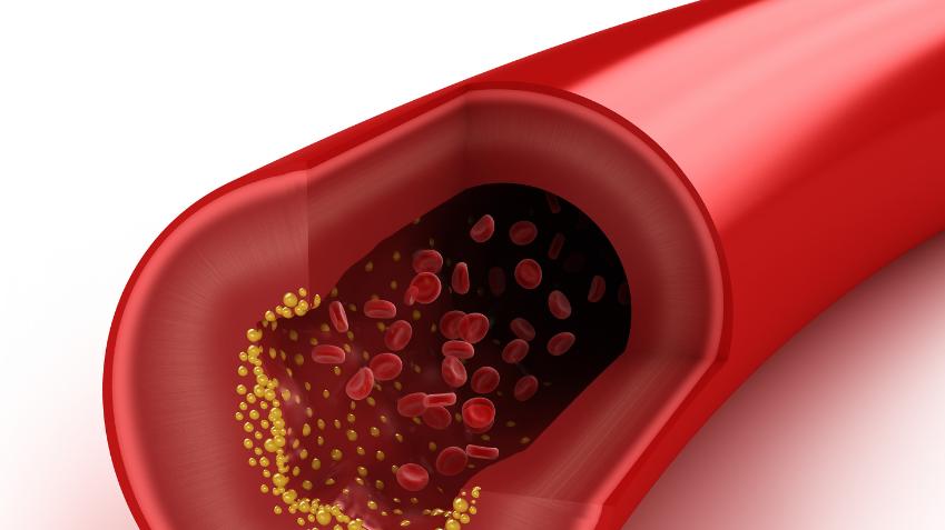 |胆固醇高的人不能吃鸡蛋？白壳鸡蛋的营养高？一文带你了解真相