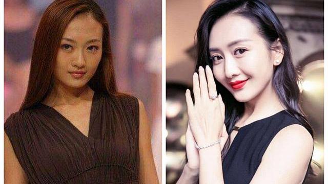 高跟鞋 6年前打美白针成“白灯泡”的女人，现在啥样，网友：还好没跟风