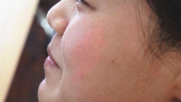 肝脏|肝脏病变，脸上或会发出3个信号，这几件事要常做，可助你排肝毒