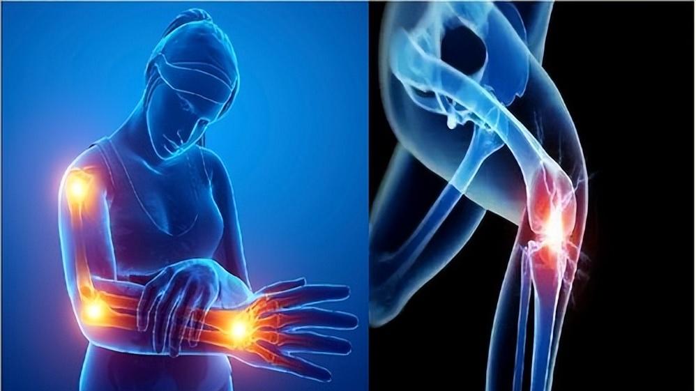 经络|经络一通，浑身轻松，分享4个中成药，通络、祛湿、散寒