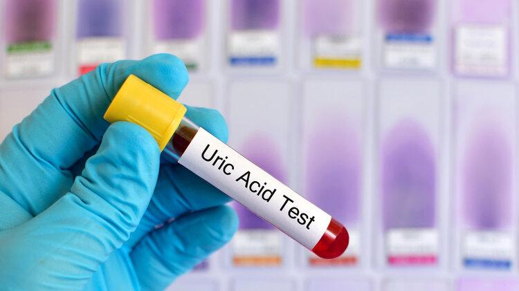 高尿酸血症|尿酸高，让全身器官受损！为你总结：4个方法，降低高尿酸