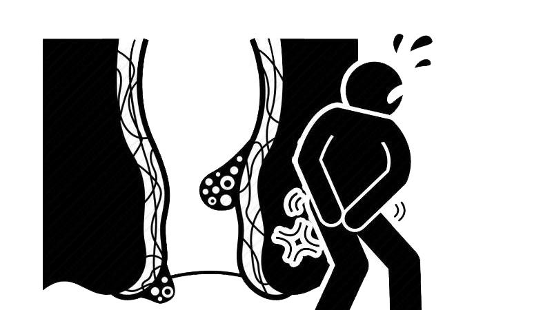 运动|提肛运动的好处体现在哪里？一般在这几个方面，你可能不知道