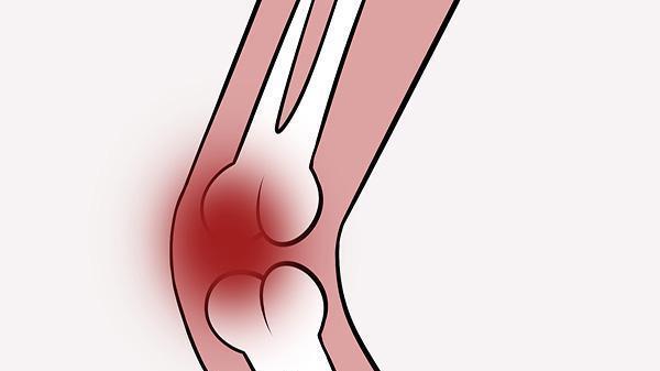 补钙|50岁后骨骼老化，应该补钙，还是补氨糖？或者2个都补？一文说清
