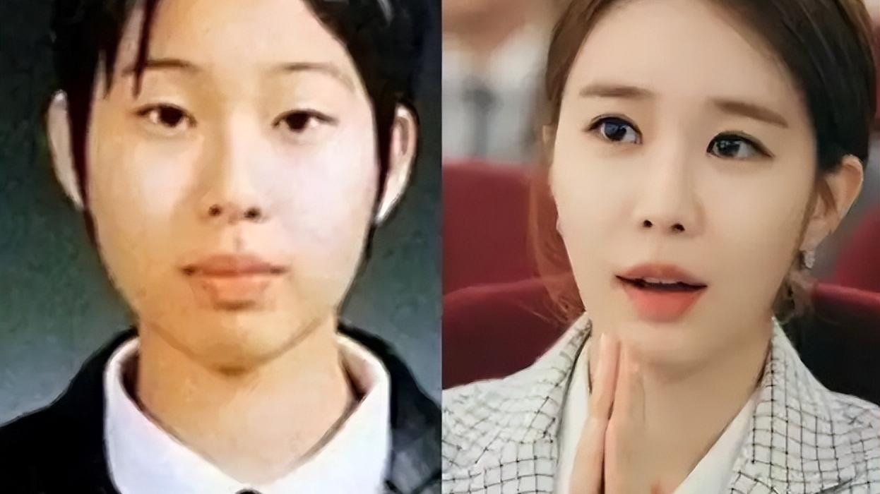 高允真|美术生疑自制整容方案，后靠一组照片爆火，却因1部剧原形毕露？