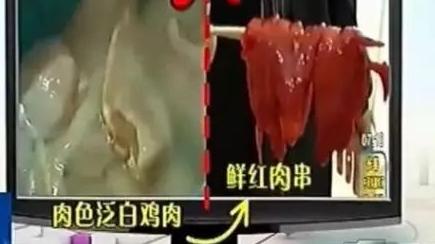 中药|女子体内取出468颗结石：惜命的最好方式不是养生，而是好好吃饭