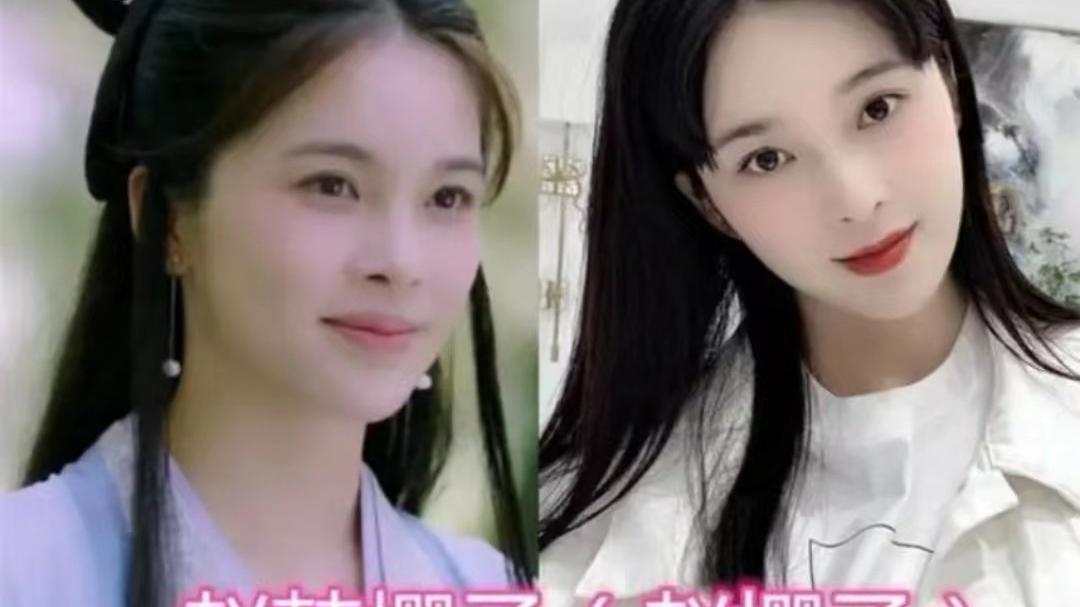 整容|整容、打针、过度减肥，9位浪姐为美太疯狂，面部僵硬认不出