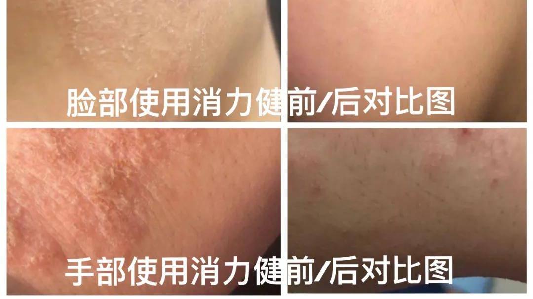 护肤|正确的护肤方式才可以让脸变得更水润光滑