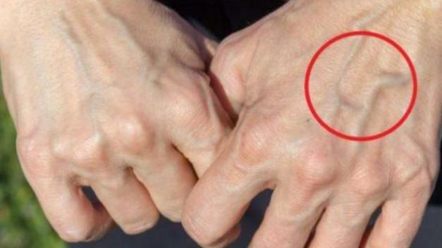 运动|有的人手臂“青筋暴起”，而有的人几乎看不到青筋，哪种更健康