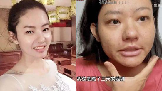 尿毒症|从毫无征兆到尿毒症，仅4年！29岁女网红：这个习惯毁了我！